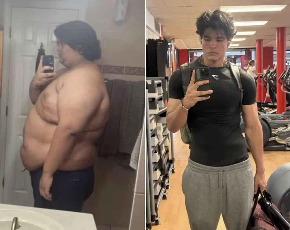 Jovem perde 124 kg após mudar alimentação e rotina de exercícios