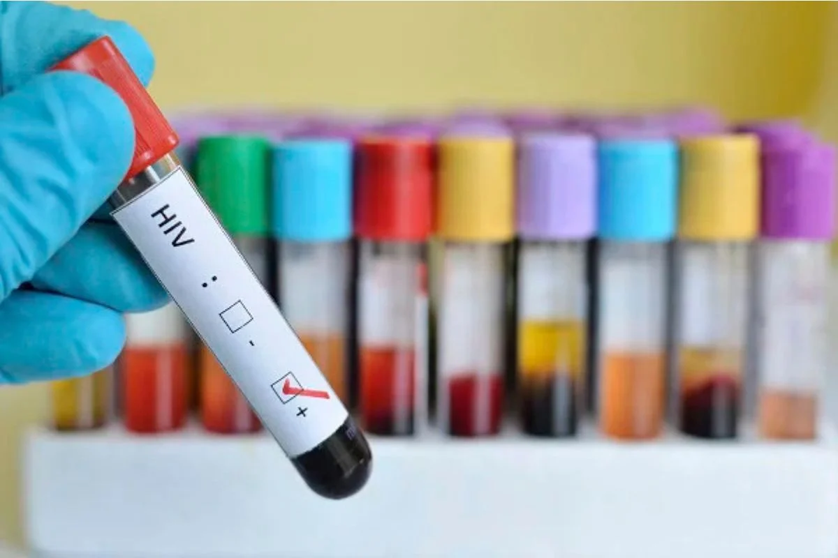 Brasil terá acesso a novo medicamento injetável para prevenção do HIV