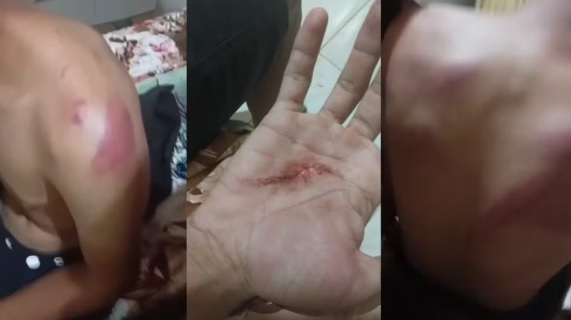 Família denuncia que policiais torturaram jovem com faca, marteladas e saco na cabeça em Capistrano